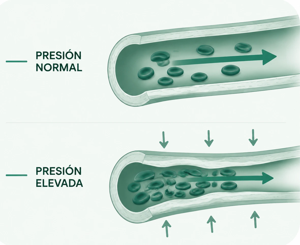 Ilustración comparativa de presión arterial normal y presión elevada
